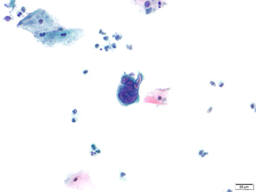 奧林巴斯顯微鏡